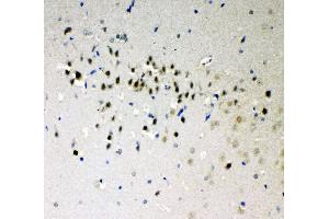Anti-DDX5 antibody, IHC(P) IHC(P): Rat Brain Tissue