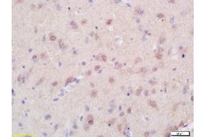 Formalin-fixed and paraffin embedded rat brain labeled with Rabbit Anti Menin/Men1 Polyclonal Antibody, Unconjugated (ABIN676343) at 1:200 followed by conjugation to the secondary antibody and DAB staining