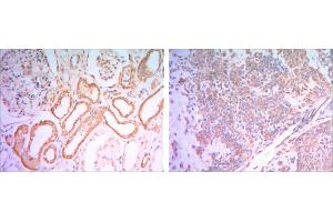 Immunohistochemical analysis of paraffin-embedded human salivary gland tissues (left) and kidney tissues (right) using HK1 antibody with DAB staining. (Hexokinase 1 antibody)