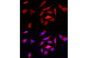 Immunofluorescence analysis of U2OS cells using ODC1 Rabbit pAb (ABIN3015743, ABIN3015744, ABIN3015745 and ABIN6219097) at dilution of 1:50 (40x lens).