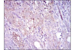 Immunohistochemistry (IHC) image for anti-Sequestosome 1 (SQSTM1) (AA 232-356) antibody (ABIN1846090) (SQSTM1 antibody  (AA 232-356))