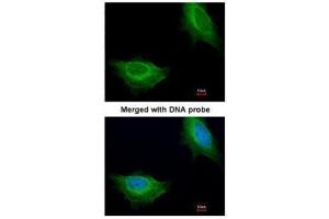 ICC/IF Image Immunofluorescence analysis of paraformaldehyde-fixed HeLa, using ADCK1, antibody at 1:200 dilution. (ADCK1 antibody)