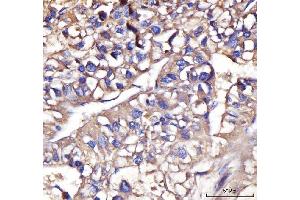 IHC analysis of IFIT5 using anti-IFIT5 antibody (ABIN7600752). (IFIT5 antibody  (AA 23-439))