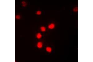 Immunofluorescent analysis of NF-kappaB p65 (pT435) staining in K562 cells. (NF-kB p65 antibody  (C-Term, pSer435))