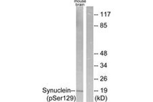 Western blot analysis of extracts from mouse brain, using Synuclein (Phospho-Ser129) Antibody. (Synuclein antibody  (pSer129))