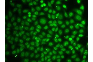 Immunofluorescence analysis of A549 cells using ZNF346 antibody (ABIN5971759). (ZNF346 antibody)