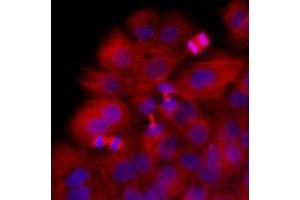 Immunofluorescence (IF) image for anti-Tubulin, beta 2B (TUBB2B) antibody (ABIN567630) (TUBB2B antibody)