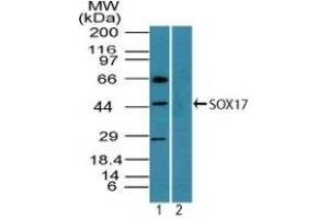 Image no. 1 for anti-SRY (Sex Determining Region Y)-Box 17 (SOX17) (AA 120-170) antibody (ABIN960351) (SOX17 antibody  (AA 120-170))