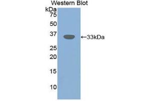 Western blot analysis of the recombinant protein. (TGFBR3 antibody  (AA 210-465))