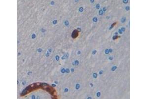 Figure. (LUM antibody  (AA 19-338))