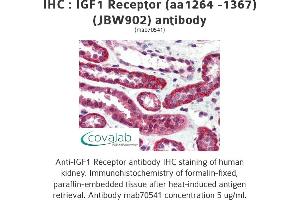 Image no. 2 for anti-Insulin-Like Growth Factor 1 Receptor (IGF1R) (AA 1264-1367) antibody (ABIN1723400) (IGF1R antibody  (AA 1264-1367))