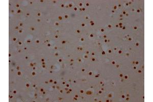 Immunohistochemistry (IHC) image for anti-Splicing Factor 3b, Subunit 1, 155kDa (SF3B1) antibody (ABIN7127805)