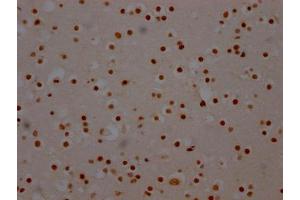 IHC image of ABIN7127805 diluted at 1:100 and staining in paraffin-embedded human brain tissue performed on a Leica BondTM system. (Recombinant SF3B1 antibody)