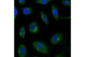 Immunofluorescence: This antibody stained HeLa cells. (CCL27 antibody)