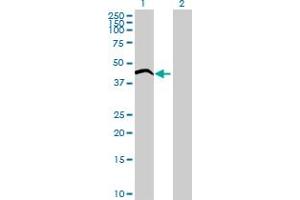 Western Blot analysis of ADPRHL1 expression in transfected 293T cell line ( H00113622-T01 ) by ADPRHL1 MaxPab polyclonal antibody. (ADPRHL1 antibody  (AA 1-354))