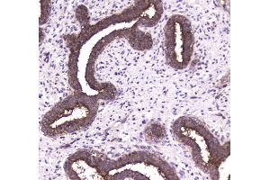 IHC analysis of 14-3-3 zeta/delta using anti-14-3-3 zeta/delta antibody . (14-3-3 zeta antibody)