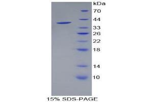 SDS-PAGE (SDS) image for Pancreatic Polypeptide (PPY) (AA 30-87) protein (His tag,GST tag) (ABIN2123440)