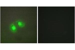 Immunofluorescence analysis of A549 cells, using TOP2A Antibody. (Topoisomerase II alpha antibody  (AA 1-50))