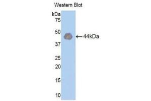 Western Blotting (WB) image for anti-Hexokinase 1 (HK1) (AA 413-540) antibody (ABIN1859172) (Hexokinase 1 antibody  (AA 413-540))