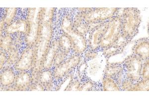 Detection of FIGN in Human Kidney Tissue using Polyclonal Antibody to Fidgetin (FIGN) (Fidgetin antibody  (AA 1-308))