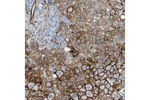 Immunohistochemical staining of human liver with HSPA12A polyclonal antibody  shows strong membranous and cytoplasmic positivity in hepatocytes. (HSPA12A antibody)