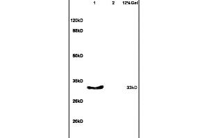 Lane 1: mouse embryo lysates Lane 2: mouse intestine lysates probed with Anti- EKLF/KLF1, 2, 4 Polyclonal Antibody, Unconjugated (ABIN1386255) at 1:200 in 4 °C. (KLF1/2/4 antibody  (AA 279-303))
