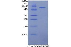 SDS-PAGE of Protein Standard from the Kit (Highly purified E. (Glucocorticoid Receptor ELISA Kit)