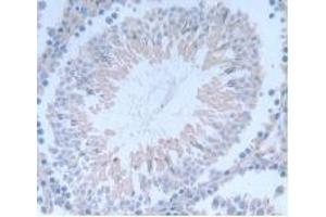 Detection of INHbA in Rat Testis Tissue using Monoclonal Antibody to Inhibin Beta A (INHbA)