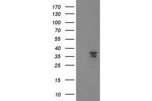 HEK293T cells were transfected with the pCMV6-ENTRY control (Left lane) or pCMV6-ENTRY CDK2 (Right lane) cDNA for 48 hrs and lysed. (CDK2 antibody)