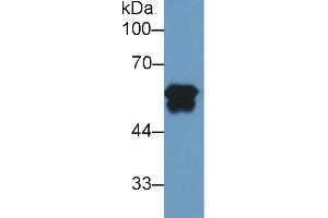 Western blot analysis of Human Liver lysate, using Human FGb Antibody (2 µg/ml) and HRP-conjugated Goat Anti-Mouse antibody ( (Fibrinogen beta Chain antibody)