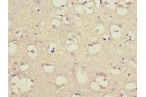 Immunohistochemistry of paraffin-embedded human brain tissue using ABIN7158053 at dilution of 1:100 (LINGO1 antibody  (AA 42-240))