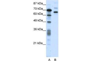 Western Blotting (WB) image for anti-CCCTC-Binding Factor (Zinc Finger Protein)-Like (CTCFL) antibody (ABIN2461294)