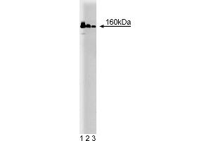 Western Blotting (WB) image for anti-MutS Homolog 6 (E. Coli) (MSH6) (AA 225-333) antibody (ABIN968248) (MSH6 antibody  (AA 225-333))