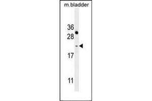 Western blot analysis of NAT14 Antibody (N-term) in mouse bladder tissue lysates (35ug/lane). (NAT14 antibody  (N-Term))