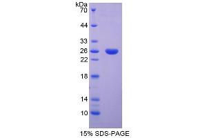 SDS-PAGE analysis of Rat SPB Protein.