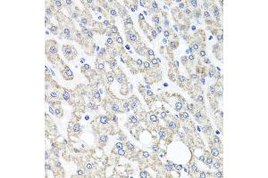 Immunohistochemistry of paraffin-embedded human liver injury using OTC antibody. (OTC antibody)