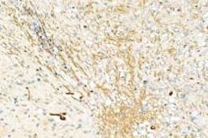 Immunohistochemistry analysis of paraffin-embedded mouse brain using,DMPK (ABIN7073790) at dilution of 1: 2000 (DMPK antibody)