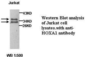 Image no. 1 for anti-Homeobox A1 (HOXA1) antibody (ABIN1577055) (HOXA1 antibody)