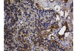 Image no. 2 for anti-TSC22 Domain Family, Member 1 (TSC22D1) antibody (ABIN1501537) (TSC22D1 antibody)
