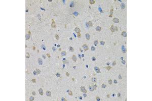 Immunohistochemistry of paraffin-embedded mouse brain using PTK7 antibody. (PTK7 antibody)