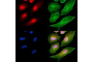 ABIN6265446 and ABIN6278639 staining  cells by IF/ICC.