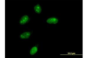 Immunofluorescence of purified MaxPab antibody to NMNAT1 on HeLa cell.