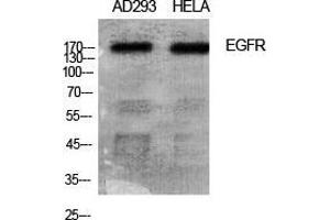 Western Blot (WB) analysis of specific cells using EGFR Polyclonal Antibody. (EGFR antibody  (Ser315))