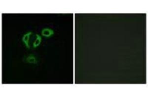 Immunofluorescence analysis of A549cells, using TACC3 antibody. (TACC3 antibody  (C-Term))