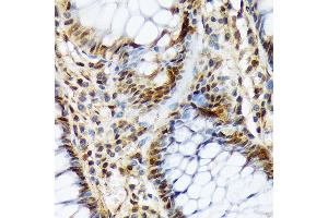 Immunohistochemistry of paraffin-embedded human colon using COPS3 Rabbit mAb (ABIN7266498) at dilution of 1:100 (40x lens). (COPS3 antibody)