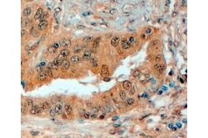 ABIN334487 (4µg/ml) staining of paraffin embedded Human Prostate. (SEMA3E antibody  (Internal Region))