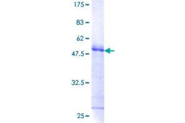 FHL3 Protein (AA 1-280) (GST tag)