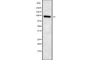 Western blot analysis of ADAM23 using Jurkat whole cell lysates (Adam23 antibody  (C-Term))