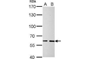 WB Image SOCS5 antibody detects SOCS5 protein by Western blot analysis. (SOCS5 antibody  (N-Term))