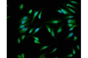 Immunofluorescence staining of Hela cells with ABIN7146926 at 1:266, counter-stained with DAPI. (Caspase 1 antibody  (AA 120-269))